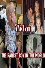 Watch Aidan The Rarest Boy In The World Niter