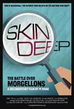 Watch Skin Deep: The Battle Over Morgellons Niter
