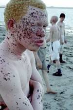 Watch Albino United Niter