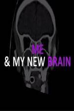 Watch Me & My New Brain Niter