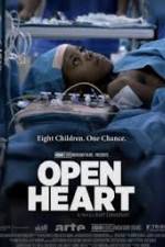Watch Open Heart Niter