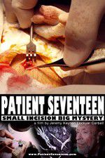 Watch Patient Seventeen Niter