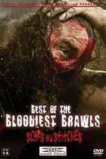 Watch TNA Wrestling: Best of the Bloodiest Brawls - Scars and Stitches Niter