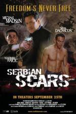 Watch Serbian Scars Niter