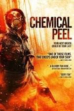 Watch Chemical Peel Niter