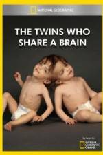 Watch National Geographic The Twins Who Share A Brain Niter