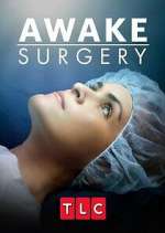 Watch Awake Surgery Niter