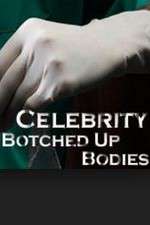 Watch Celebrity Botched Up Bodies Niter